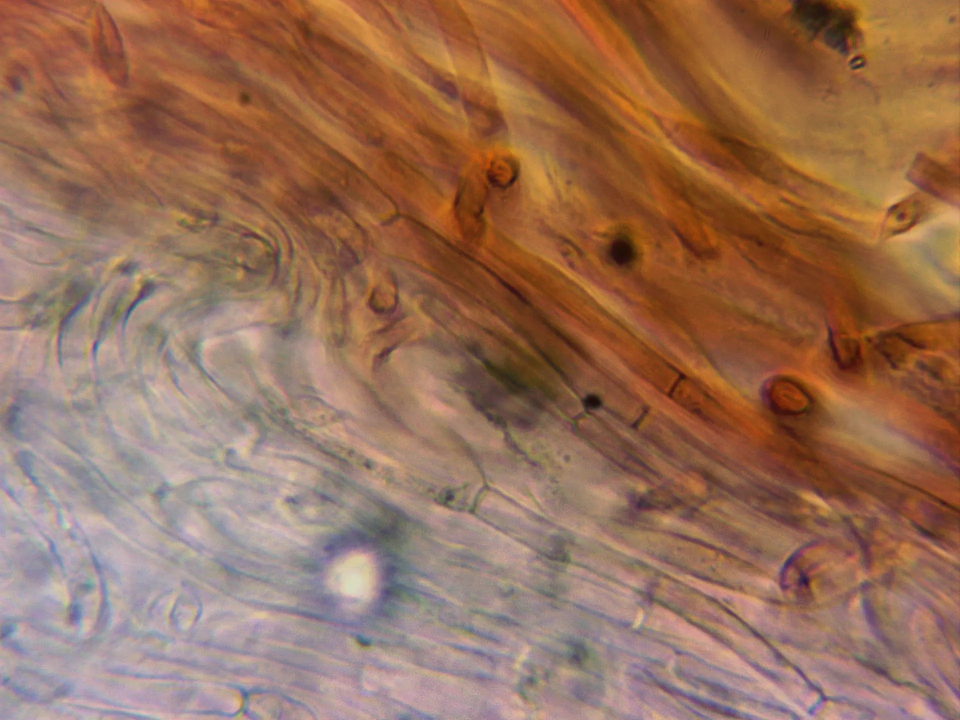 Microscopía de Tricholoma columbetta - 6 - Cutícula
